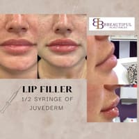 BBeautiful Injectables - permanent makeup work