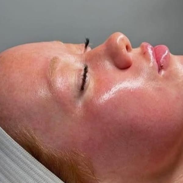 Beauti4Skin Medspa n Laser - permanent makeup in Spring, TX