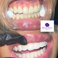 Beauty Exposed - permanent makeup work