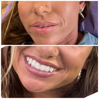 Body of Courage LLC - permanent makeup work