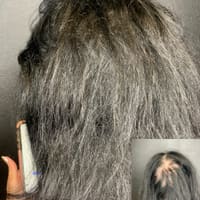 Bravado Scalp MicroPigmentation - permanent makeup work
