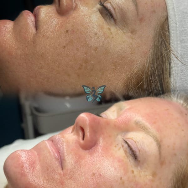 Butterfly PMU Salon & Spa - permanent makeup in Pensacola, FL