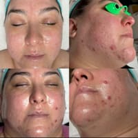 Crystal Pure Skin Care - permanent makeup work