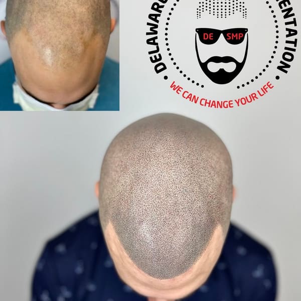 Delaware Scalp Micropigmentation - permanent makeup in Wilmington, DE