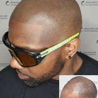 Denny.Micro.Ink Scalp Micropigmentation Houston - permanent makeup work