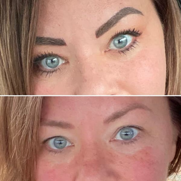 Dermasology - permanent makeup in Glastonbury, CT