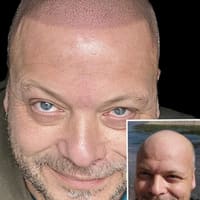 Empowerment Ink Scalp Micropigmentation - permanent makeup work