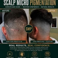 Envision Microscalp - permanent makeup work