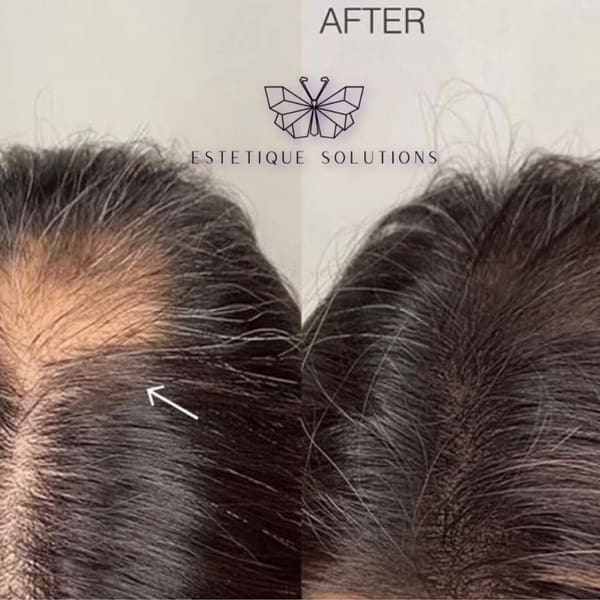 Estetique Solutions - permanent makeup in Pittsburgh, PA
