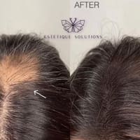 Estetique Solutions - permanent makeup work
