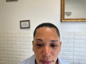 Eyebrow Tattoo result by 1 Shaping in Texas by Linda (Microblading Artistry: Eyebrow & Lip in Richardson, TX