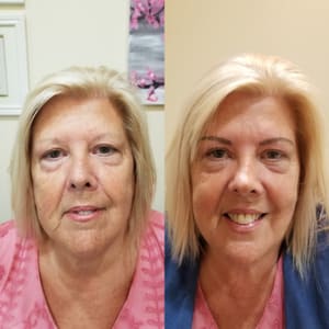 Eyebrow Tattoo result by 24 Hour Beauty Permanent Makeup by Jeni in Tacoma, WA