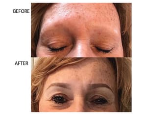 Eyebrow Tattoo result by 3D Permanent Makeup in Jacksonville, FL