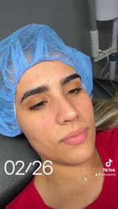 Eyebrow Tattoo result by Adele Beauty Salon in Miami Springs, FL