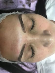 Eyebrow Tattoo result by Advanced Medical Tattooing in Clear Lake, IA