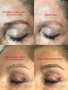 Eyebrow Tattoo result by Aestheticare Day Spa in Cambridge, MA