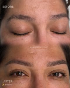 Eyebrow Tattoo result by Aglaetbeauty brows in Smithtown, NY