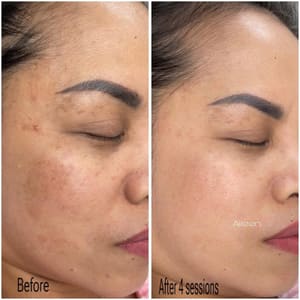 Eyebrow Tattoo result by Aileen's Beauty in Campbell, CA