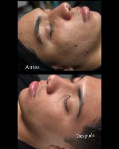 Eyebrow Tattoo result by Ale Esthetics Studio in Selden, NY