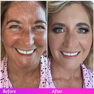 Eyebrow Tattoo result by Alhajas BeautySpa in Hallandale Beach, FL