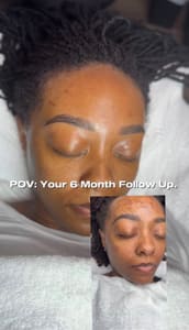 Eyebrow Tattoo result by Allured Aesthetics in Raleigh, NC
