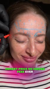 Eyebrow Tattoo result by Alsaeed Beauty in Palm Coast, FL