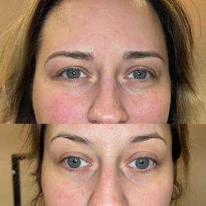 Eyebrow Tattoo result by Amanda Diveley Esthetics in Wood River, IL