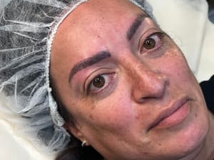 Eyebrow Tattoo result by Ana Cecilia Molina Brows & Beauty in Arlington Heights, IL