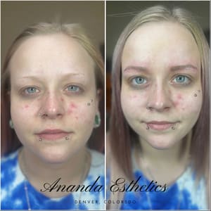 Eyebrow Tattoo result by Ananda Esthetics in Littleton, CO