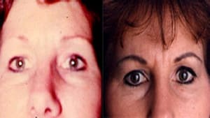 Eyebrow Tattoo result by Angel's Permanent Makeup in Boca Raton, FL