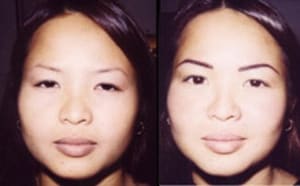 Eyebrow Tattoo result by Angel's Permanent Makeup in Boca Raton, FL