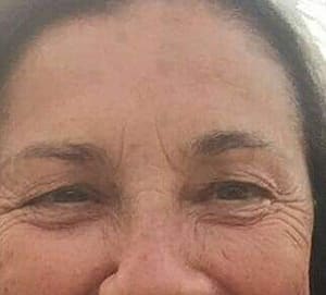 Eyebrow Tattoo result by Angel's Permanent Makeup in Boca Raton, FL