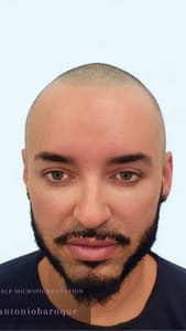 Eyebrow Tattoo result by Antonio Baroque Permanent Makeup in Las Vegas, NV