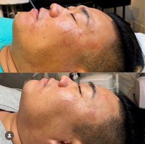 Eyebrow Tattoo result by Aphrodite Day Spa in Everett, WA