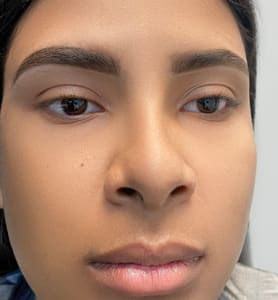 Eyebrow Tattoo result by Aqua Clinique Brows & Beauty in Cutler Bay, FL