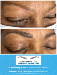 Eyebrow Tattoo result by Arlington NOVA LASER & 3D MICROBLADING in Arlington, VA
