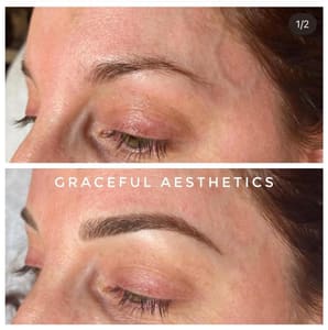 Eyebrow Tattoo result by Aura - by Graceful Aesthetics in Winter Haven, FL