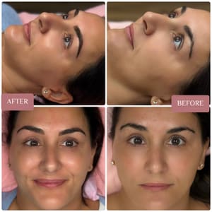Eyebrow Tattoo result by Avani Aesthetics in Durham, NC