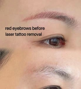 Eyebrow Tattoo result by Axon Aesthetics in Flushing, NY