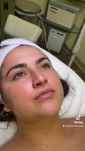 Eyebrow Tattoo result by Azani Medical Spa in Bethlehem, PA