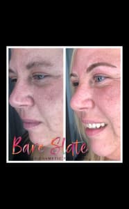 Eyebrow Tattoo result by Bare Slate in Spokane Valley, WA