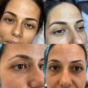 Eyebrow Tattoo result by BB permanent makeup in Huntington Beach, CA