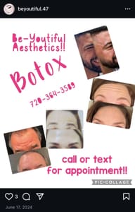Eyebrow Tattoo result by Be YOU tiful Aesthetics in Denver, CO