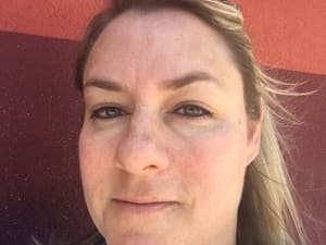 Eyebrow Tattoo result by Beaus Clinical Skin Care in Dallas, TX