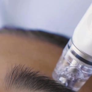 Eyebrow Tattoo result by Beauti4Skin Medspa n Laser in Spring, TX