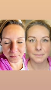 Eyebrow Tattoo result by Beauty Genesis in The Woodlands, TX