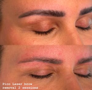Eyebrow Tattoo result by Beauty Glam Studio in Boca Raton, FL