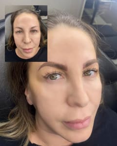 Eyebrow Tattoo result by Beauty Of Synn in Cathedral City, CA