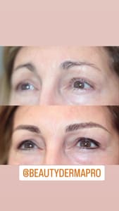 Eyebrow Tattoo result by BeautyDermaPro in Naples, FL