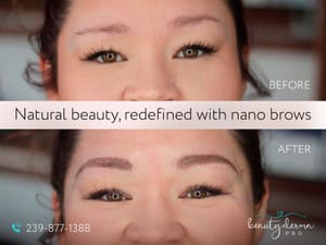 Eyebrow Tattoo result by BeautyDermaPro in Naples, FL